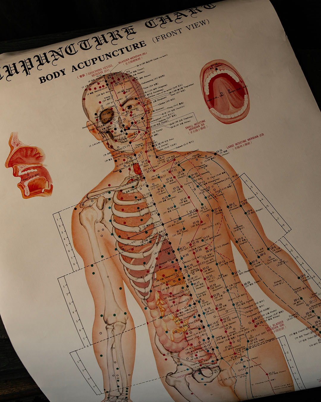 Vintage Acupuncture Poster
