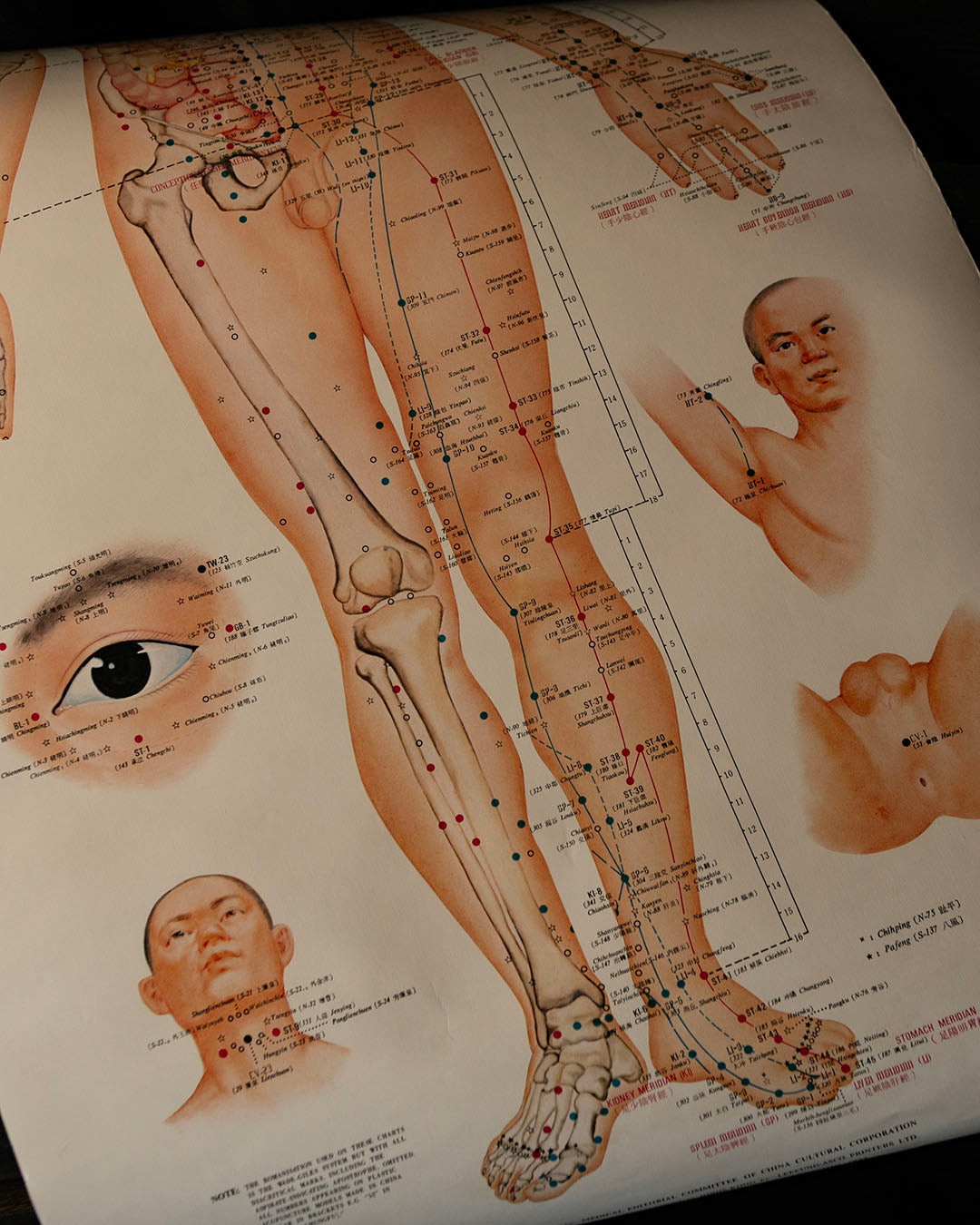 Vintage Acupuncture Poster