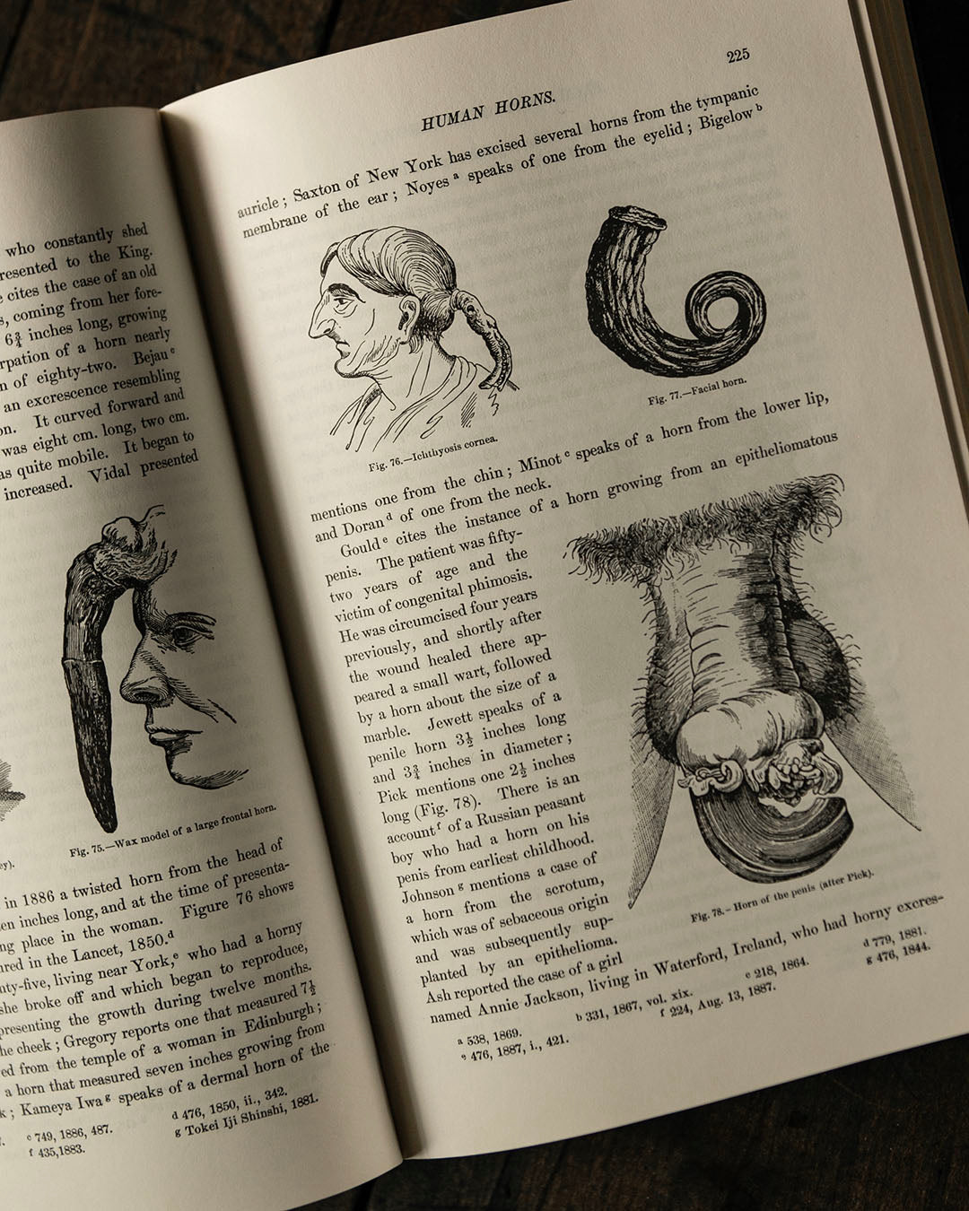 Anomalies and Curiosities in Medicine Book