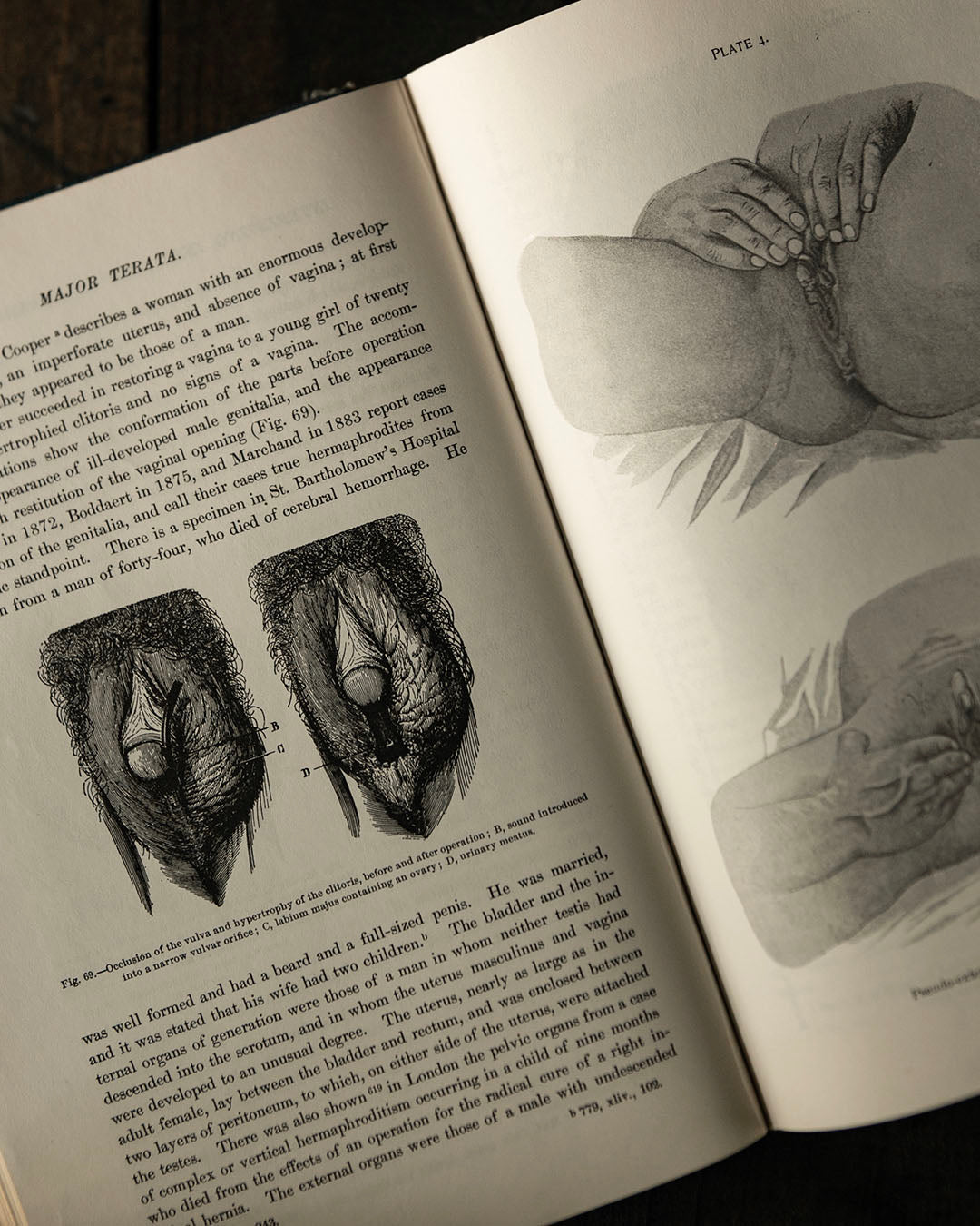 Anomalies and Curiosities in Medicine Book