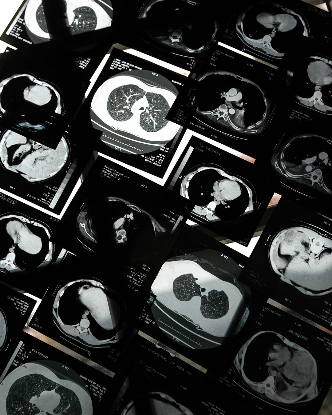 Vintage X-rays