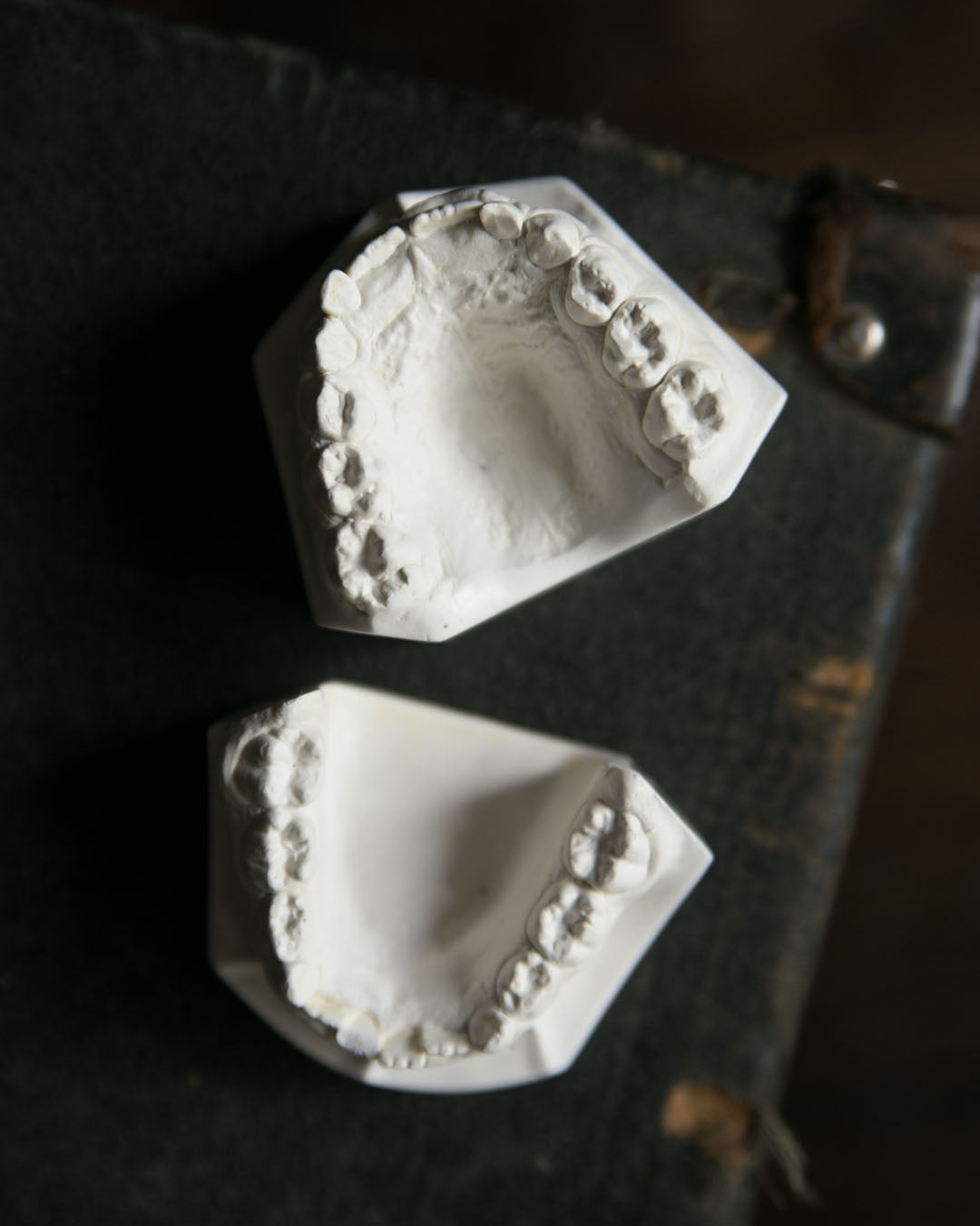 Vintage Dental Moulds