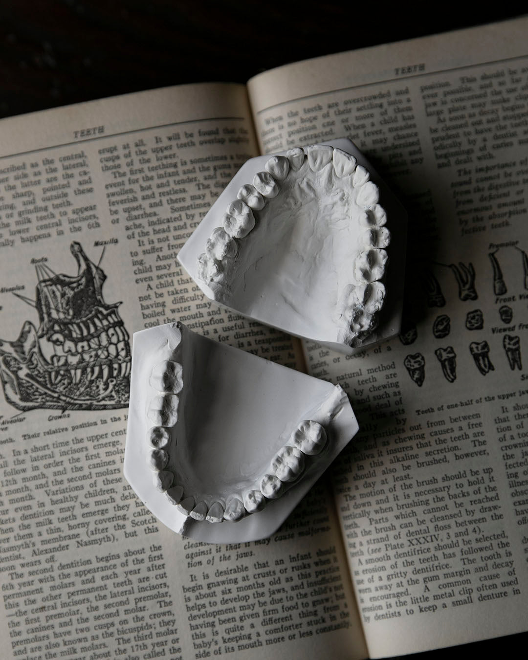 Vintage Dental Moulds