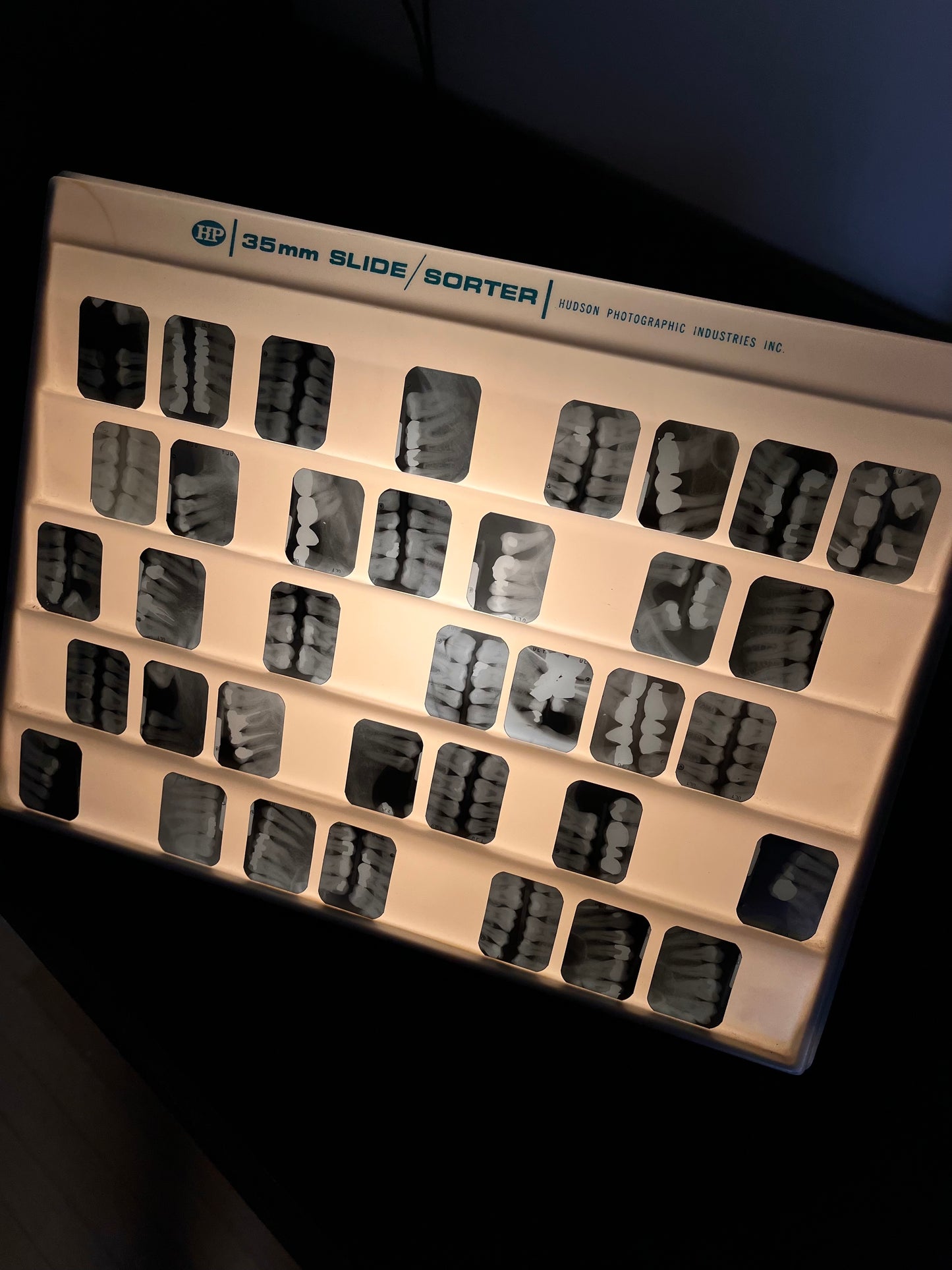 Vintage Dental X-Rays