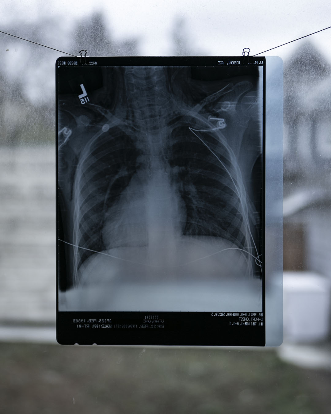 Vintage Chest X-Ray