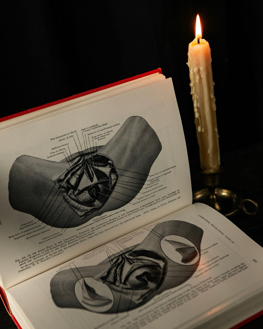 Vintage Textbook of Gynecology
