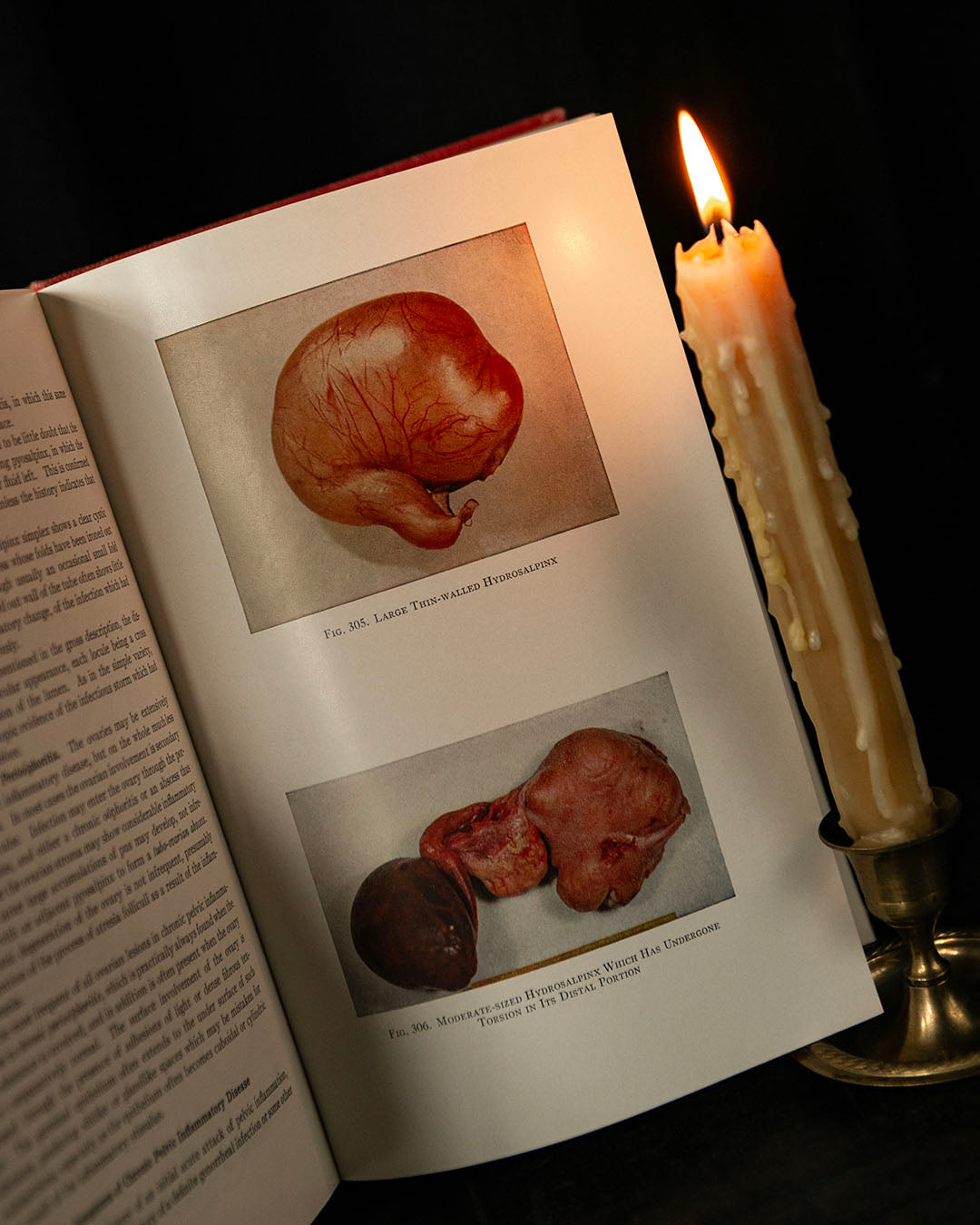 Vintage Textbook of Gynecology