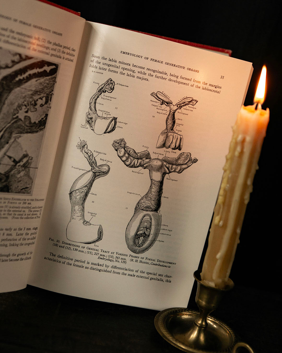Vintage Textbook of Gynecology