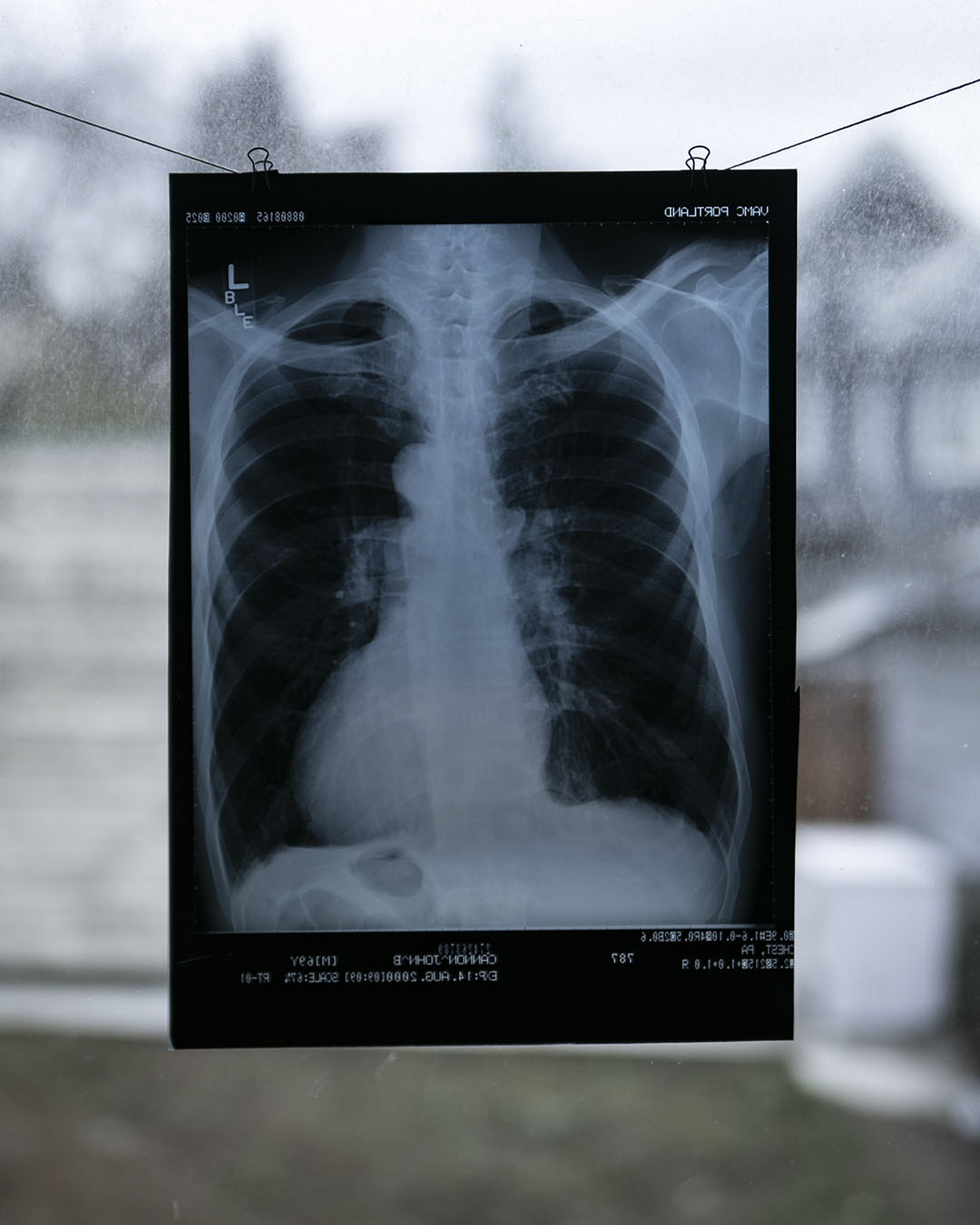 Vintage Chest X-Ray