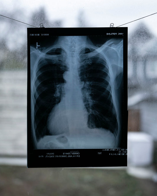 Vintage Chest X-Ray
